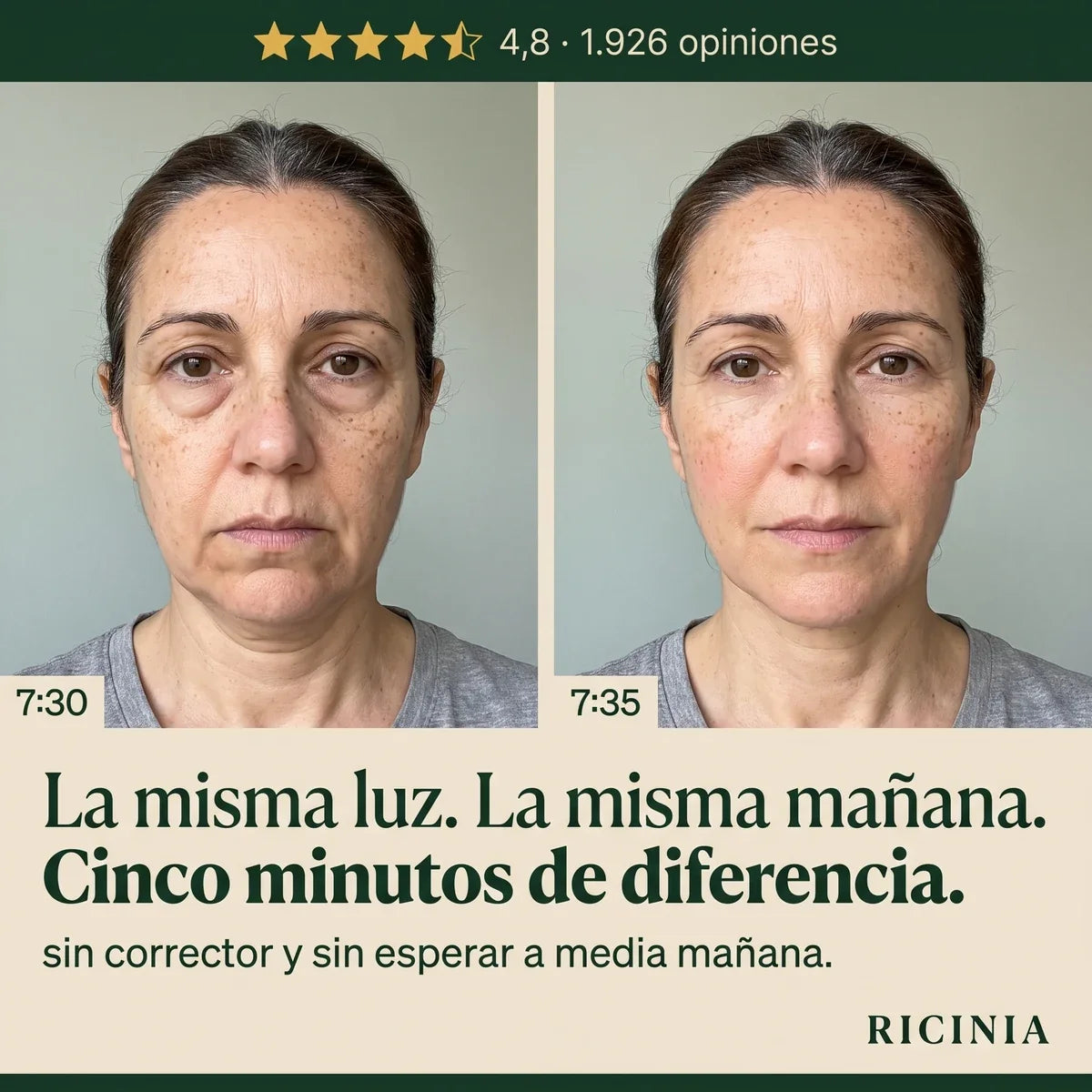 La misma cara a las 7:30 y a las 7:35, cinco minutos de diferencia